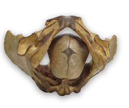 skull face down in pelvis