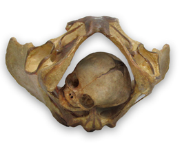 skull face out in pelvis